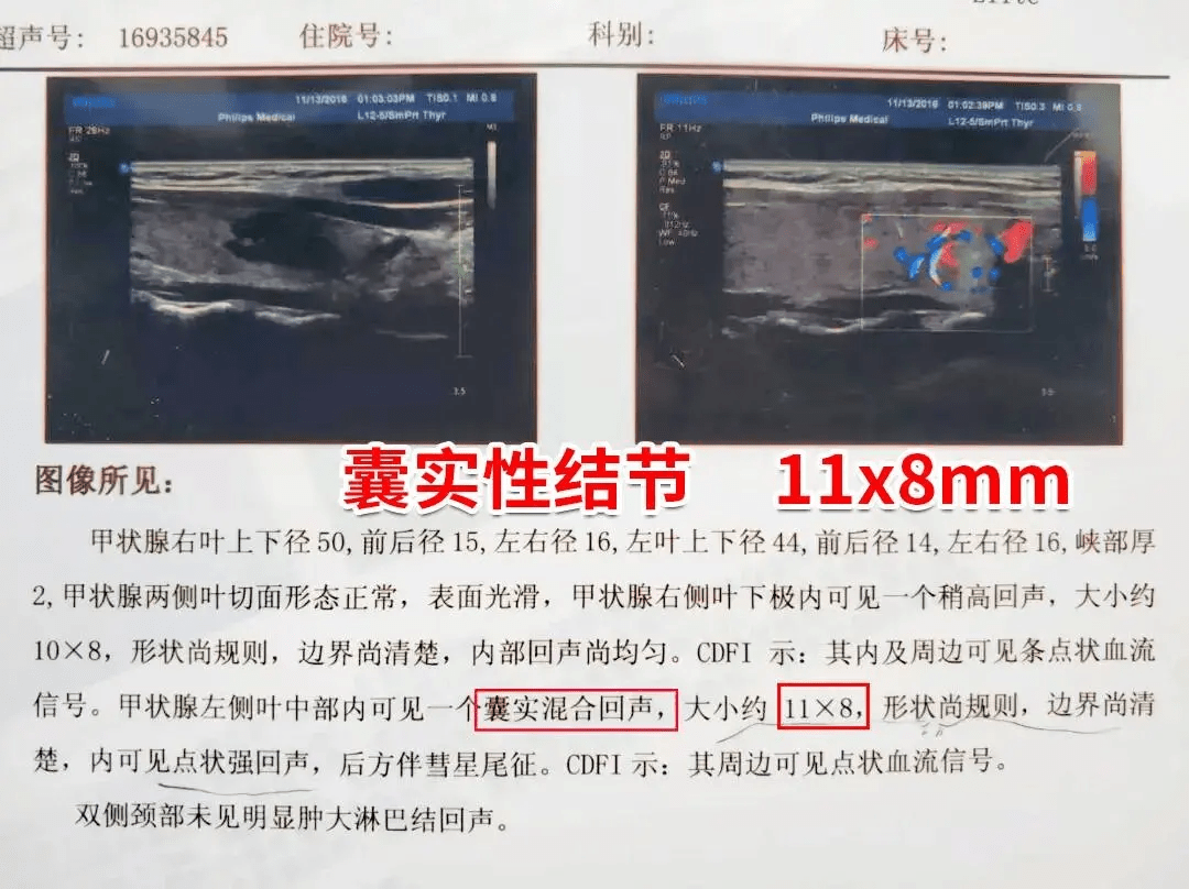 甲状腺最好的中医专家